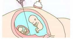 南宁代孕的方法,南宁做三代试管婴儿哪家医院好？哪家成功率高！
